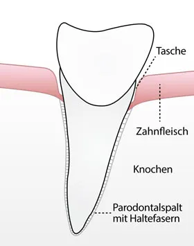Parodontologie-Behandlung in der Zahnarztpraxis Laatzen